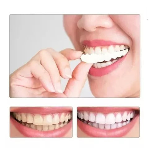 Set De Revestimiento Para Dentaduras Pos